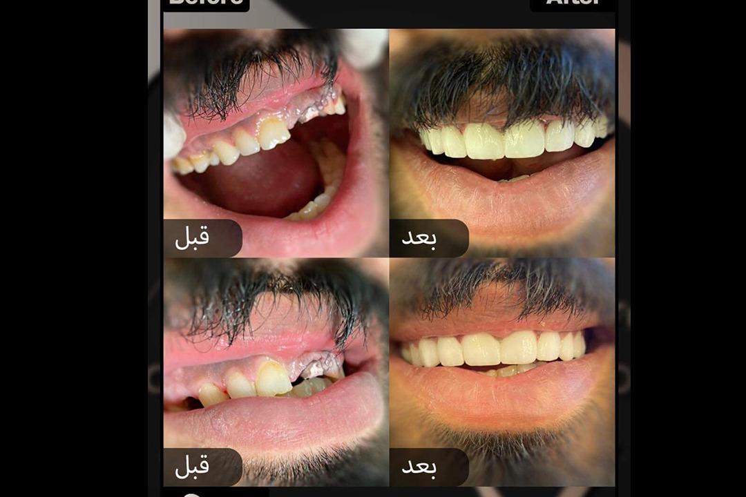 Dr. Mohannad Alaswad Cosmetic & Dentistry Banner