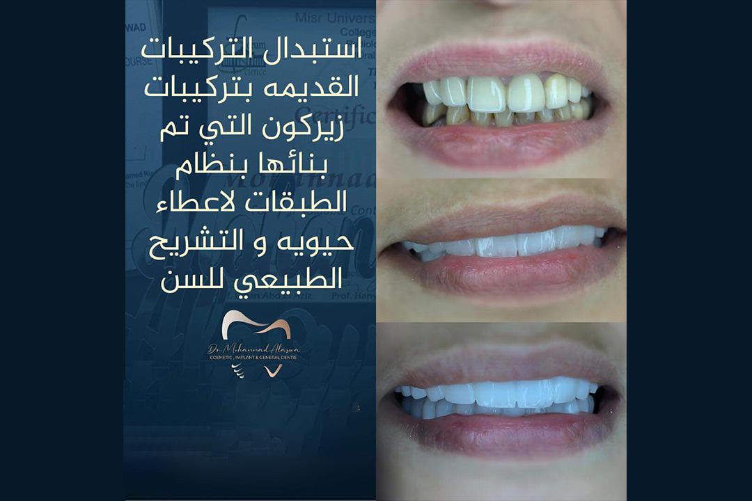 Dr. Mohannad Alaswad Cosmetic & Dentistry Banner